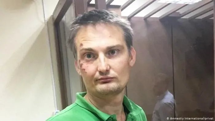 Адвокат Михаил Беньяш с травмами после задержания и избиения силовиками