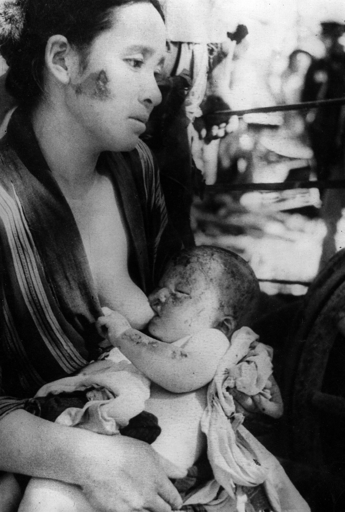 Хиросима. Выжившая японка с младенцем в ожогах, вызванных ядерным взрывом. Фото из личного архива Бенуа Жюно