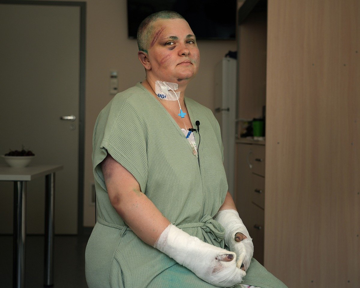 Елена Милашина в московской больнице на следующий день после избиения. Фото: Анна Артемьева / «Новая газета»