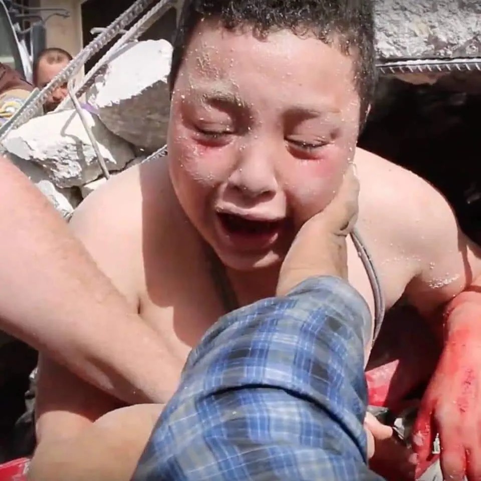 Пострадавший от авиаудара 1 июня в городе Хан Шукун в зоне деэскалации Сирии. Фото и видео к материалу предоставлены активистами «Сирийского американского медицинского общества», а также медиаактивистом, жителем Идлиба Абдурахманом А.