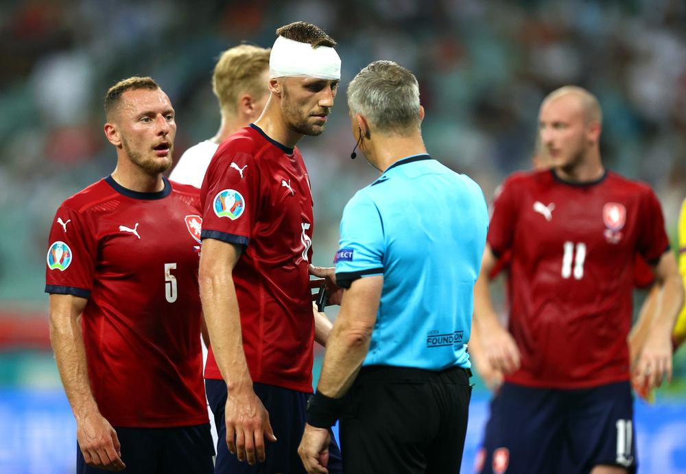 Капитан сборной Чехии Томаш Соучек (в центре), получивший травму во время матча с Данией. Фото: ЕРА
