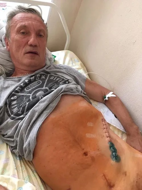 Игорь Саликов после операции / Фото: «Новая газета»