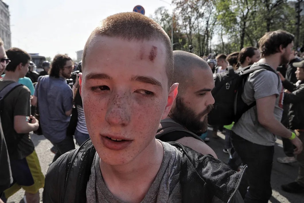 Молодой человек, получивший удар полицейской дубинкой. Фото: Влад Докшин / «Новая газета»