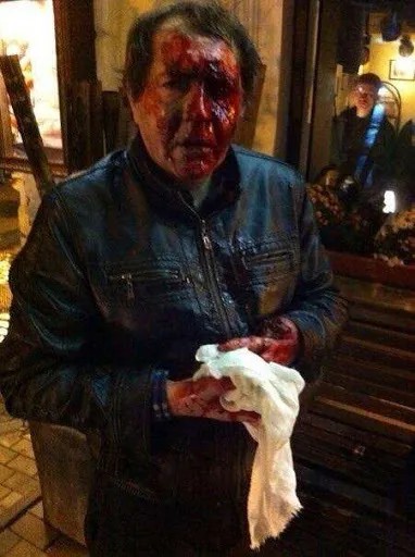Илья Романов после взрыва пиротехники. Фото: twitter.com/opernn