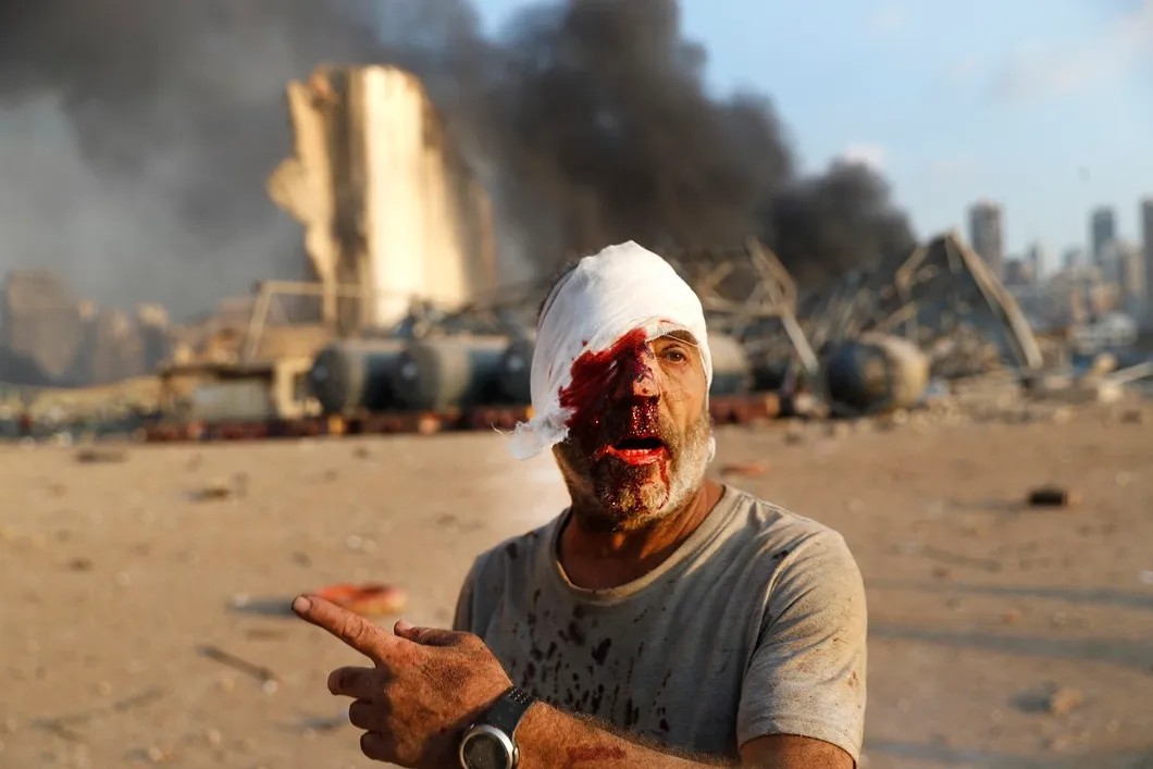Последствия взрыва в Бейруте. Фото: AP / ТАСС