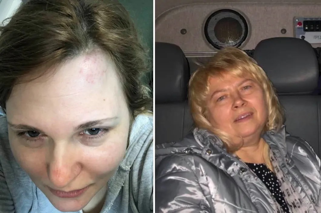 Селфи Елены Милашиной после нападения в гостинице в Грозном (слева) и адвокат Марина Дубровина в полицейском автомобиле после нападения в гостинице