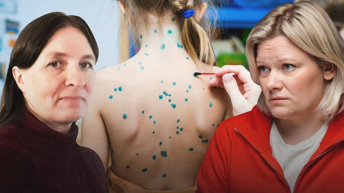 Вспышка ветрянки в России: насколько это опасно и что делать?