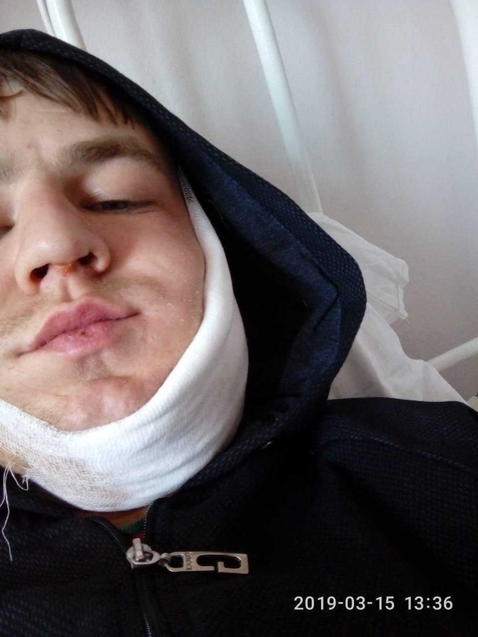 Ростислав Мельниченко в больнице с переломом челюсти. Фото: личный архив
