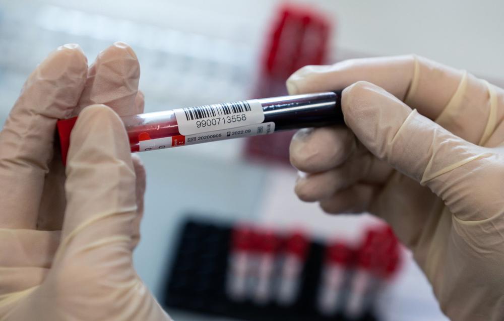 Кровь пациента для тестирования на COVID-19. Фото: РИА Новости