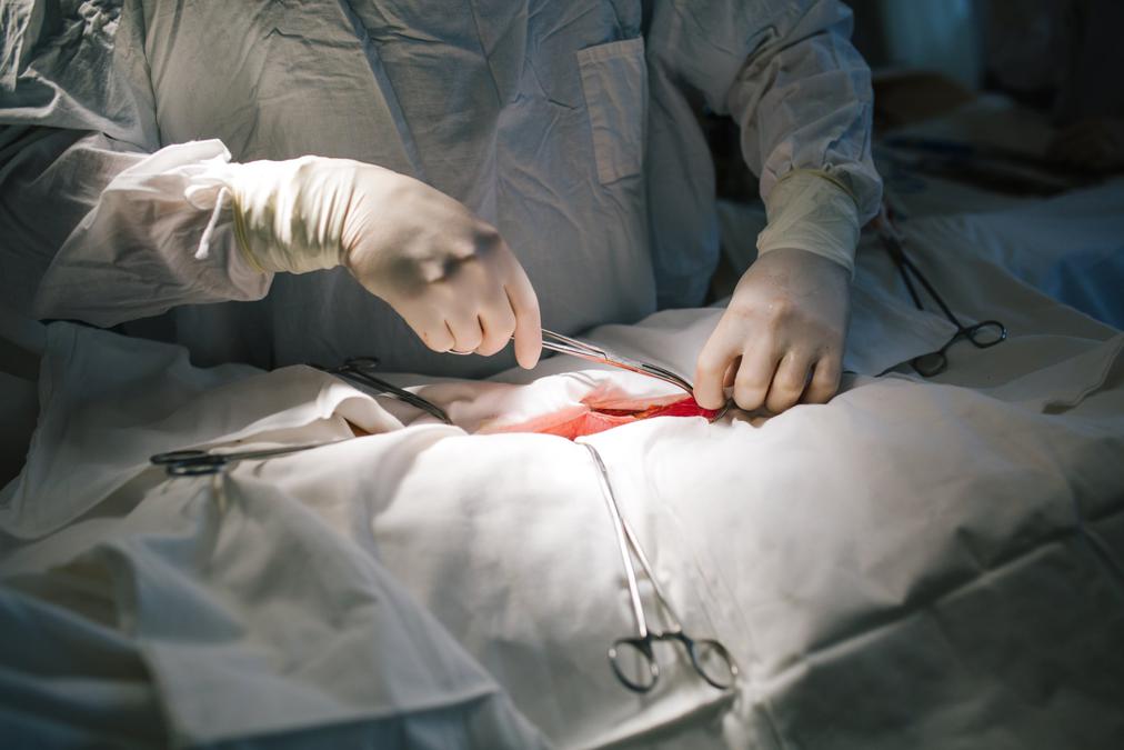 Хирург удаляет злокачественную опухоль. Фото: РИА Новости
