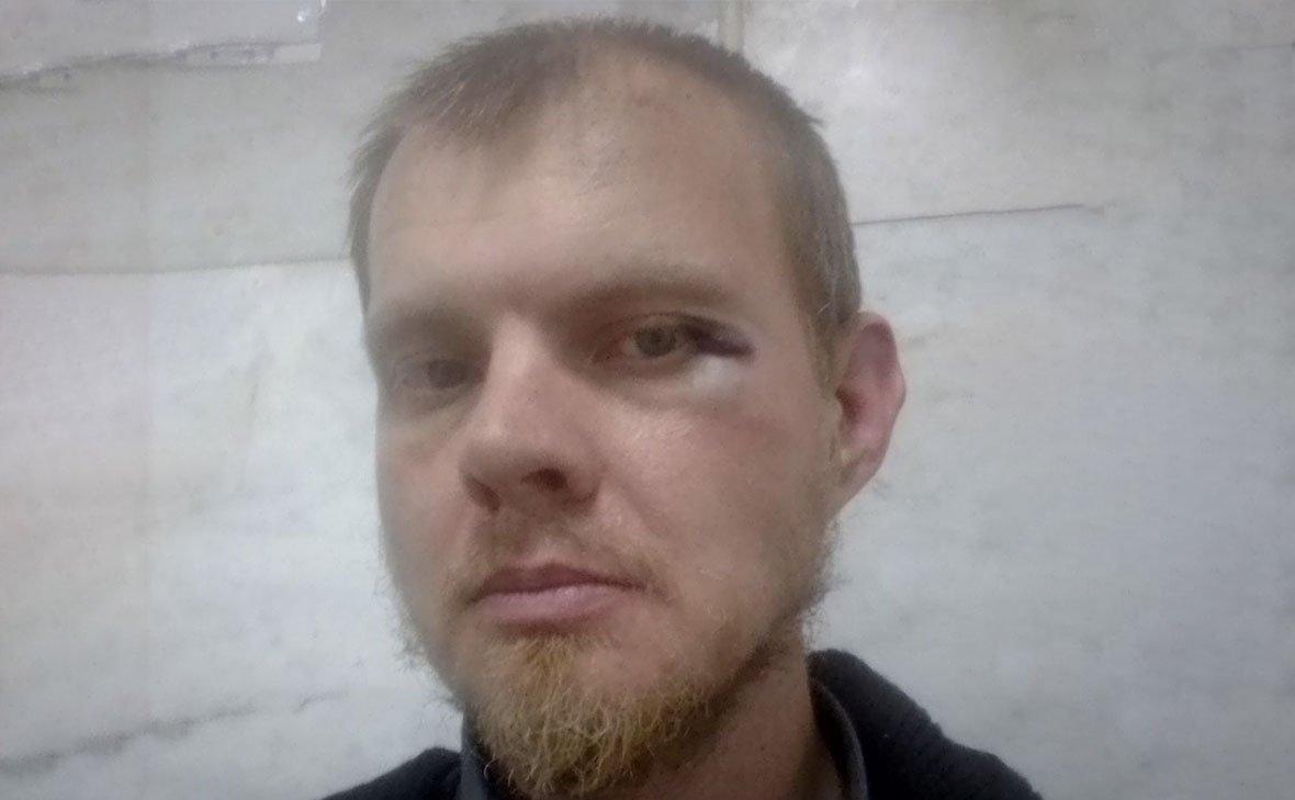 Экс-координатор штаба Навального в Челябиснке Алексей Барабошкин после нападения