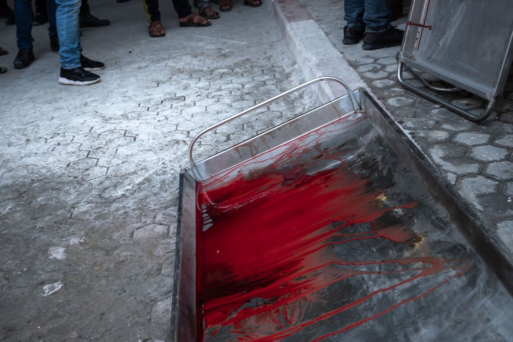 11 мая. Кровь палестинца Ахмеда аль-Шенбари, убитого во время израильского налета на город Бейт-Ханун в Газе. Фото: Getty Images