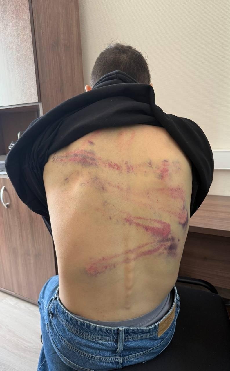 Дмитрий Останин после задержания в Минске, фото со следами побоев