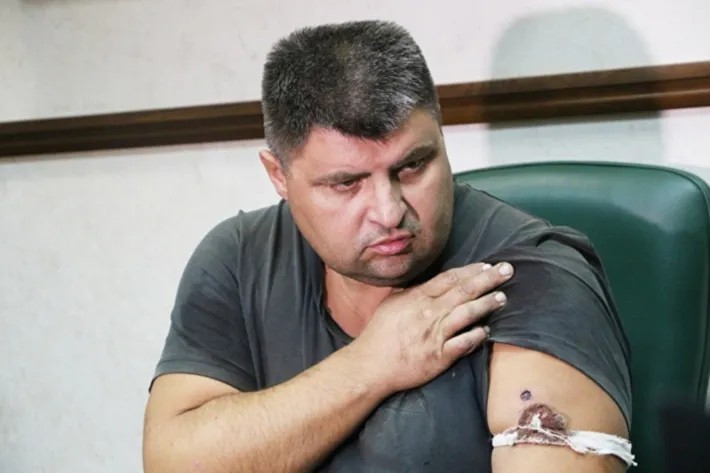 Олег Дутов демонстирует ранение в руку. Фото: Znak.com