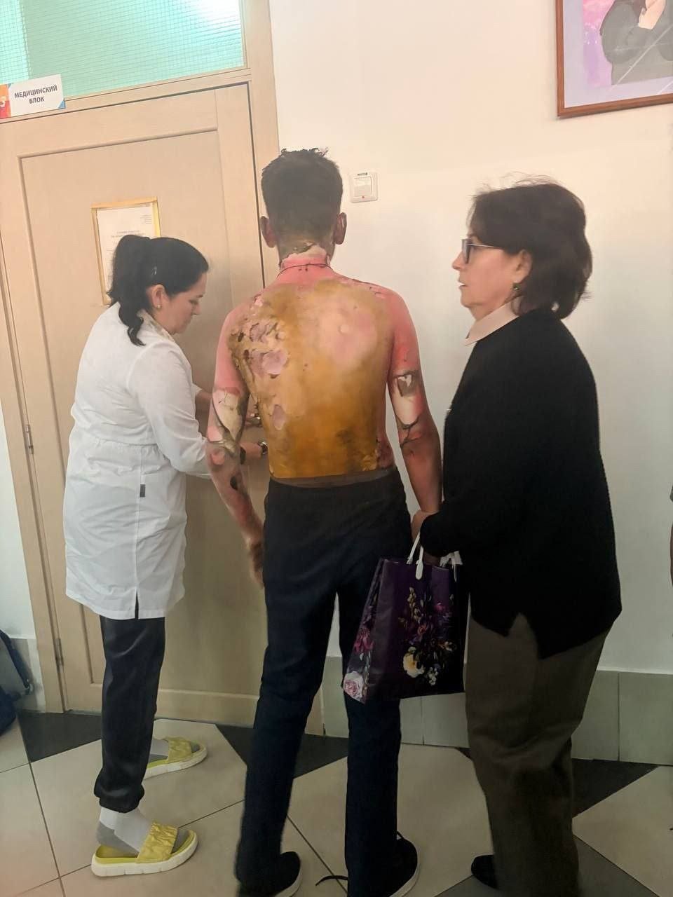 Один из пострадавших в 153-й школе Красноярска. Фото: соцсети