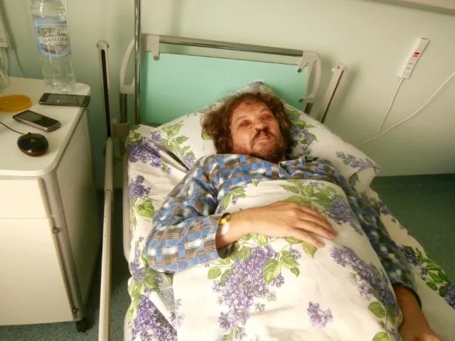 Андрей Рудомаха после избиения — в больнице
