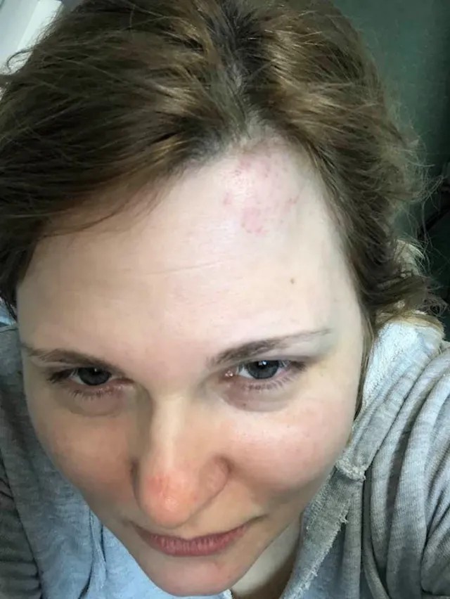 Селфи Елены Милашиной сразу после нападения 6 февраля в фойе грозненской гостиницы. На лице — ушибы и следы борьбы