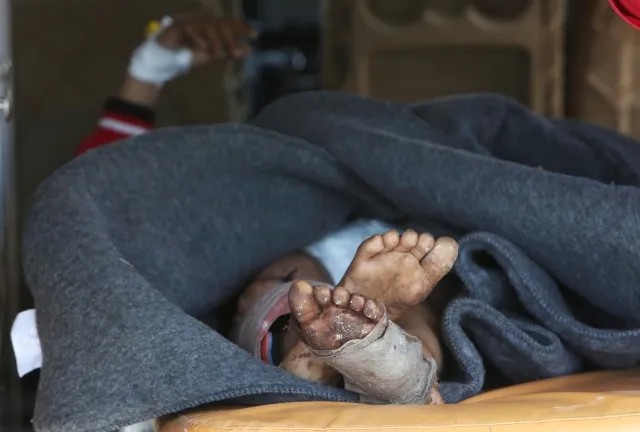 Раненый подросток в госпитале Сирии. Фото: Reuters