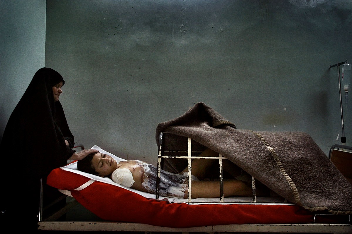 В больнице Аль-Кинди. Раненый ребенок, вся его семья погибла в результате ракетного удара на южной окраине Багдада. Ирак, 1 апреля 2003 года