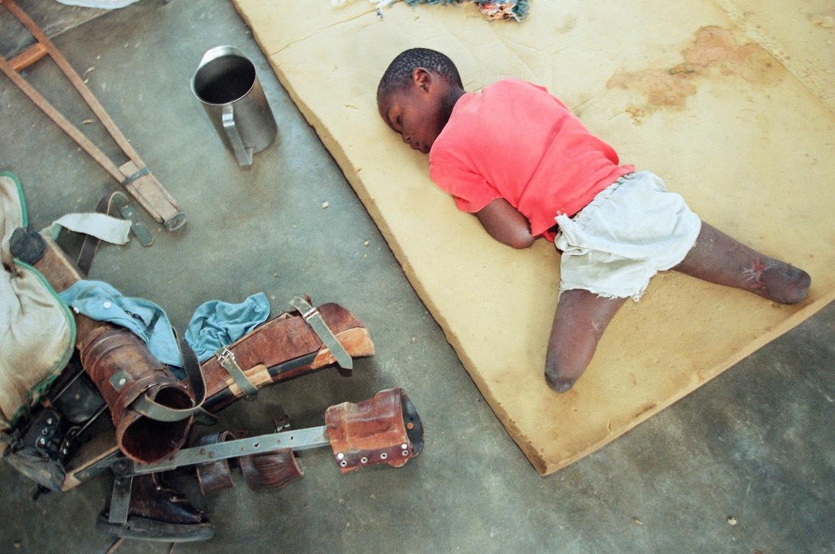 Одна из жертв геноцида в Руанде. Фото: AP / TASS