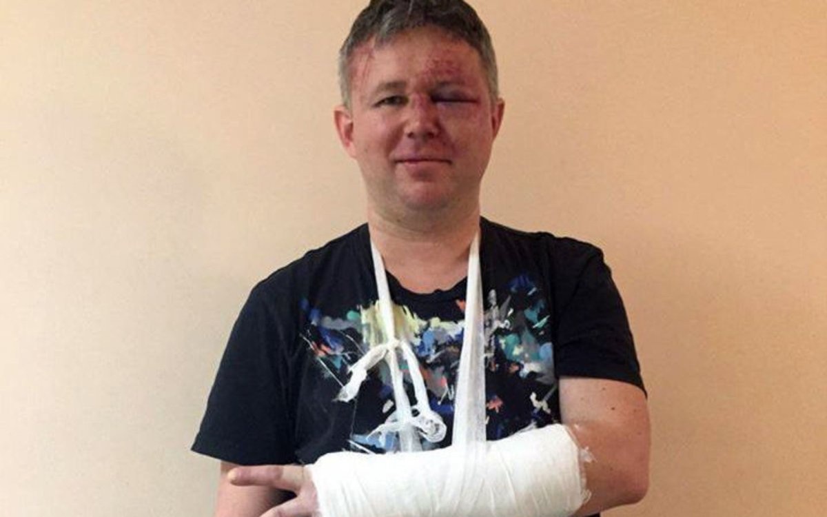 Динар Идрисов после избиения