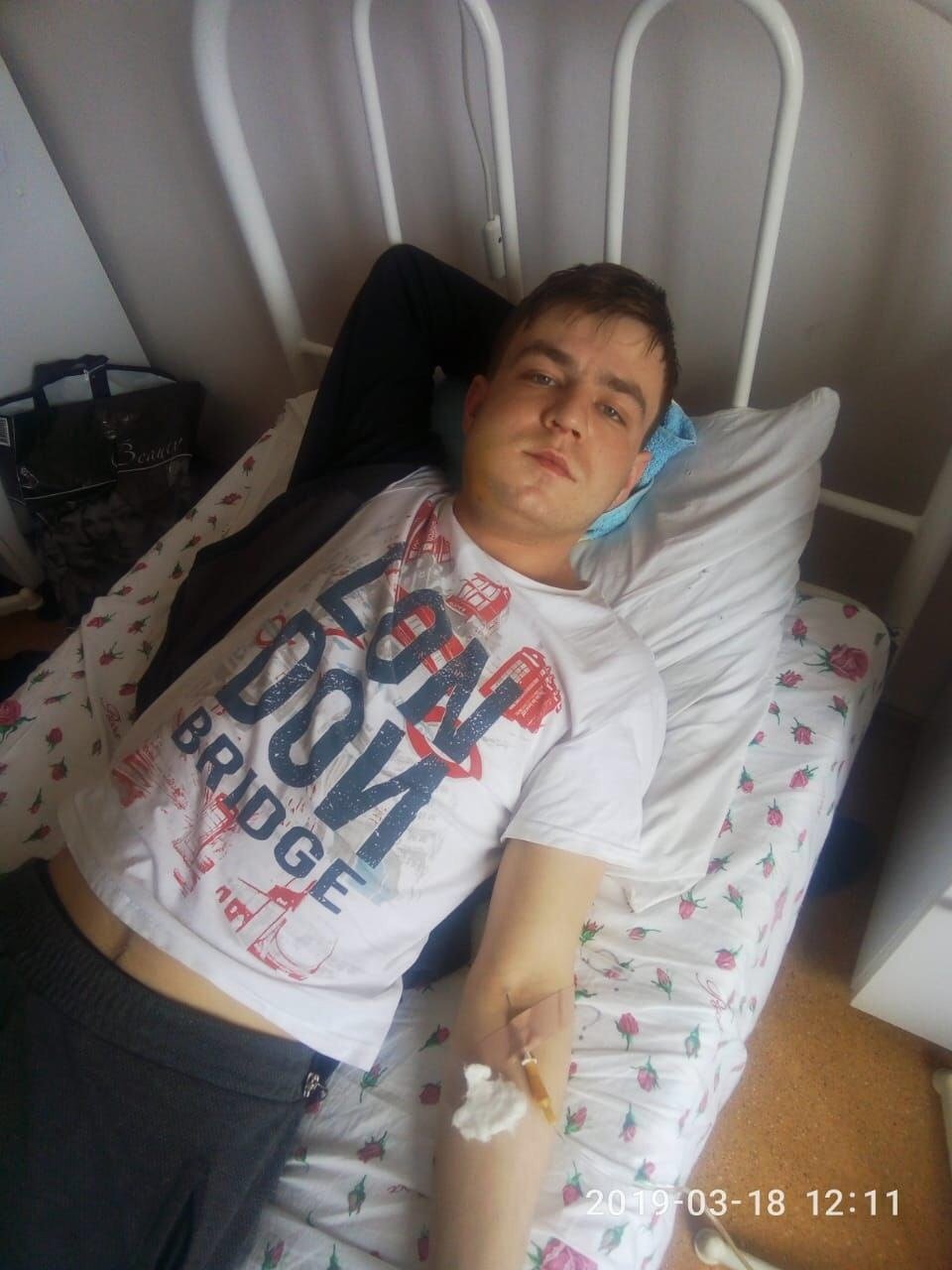 Ростислав Мельниченко в больнице с переломом челюсти. Фото: личный архив