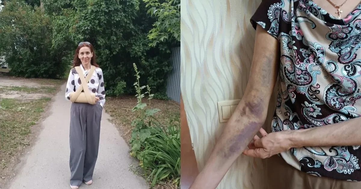 СК закрыл дело полицейских, сломавших руку учительнице в Рязани при задержании